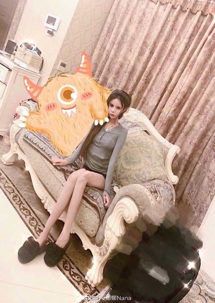 bien dang vi phau thuat tham my anh 8