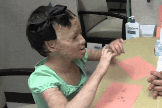 Hanh phuc khi duoc cam but cua be gai Syria sau 3 nam bi trung bom hinh anh