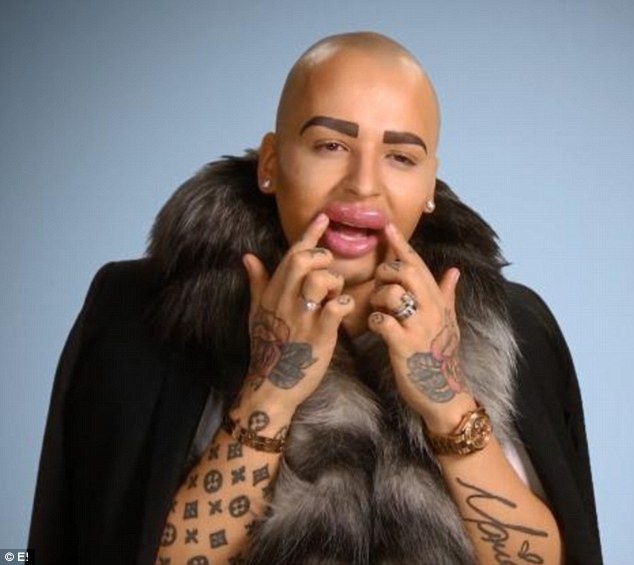 phau thuat tham my anh 9