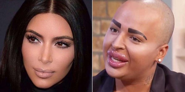 phau thuat tham my anh 8