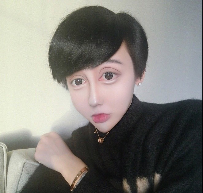 phau thuat tham my anh 5