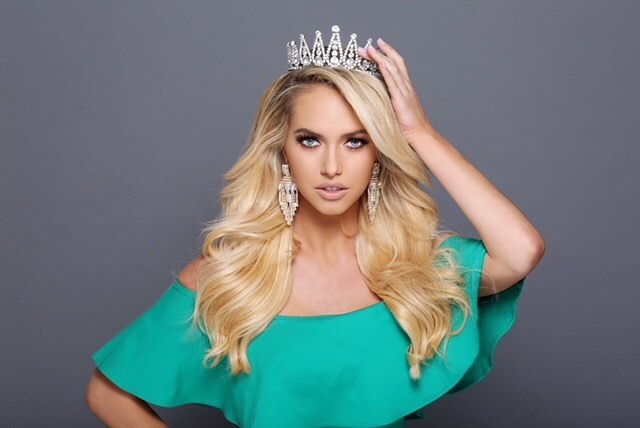 Nguoi dep san dau vo anh 5