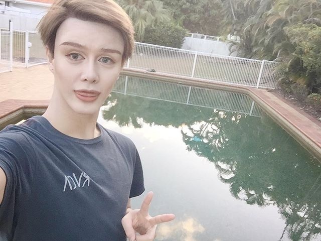 phau thuat tham my anh 6