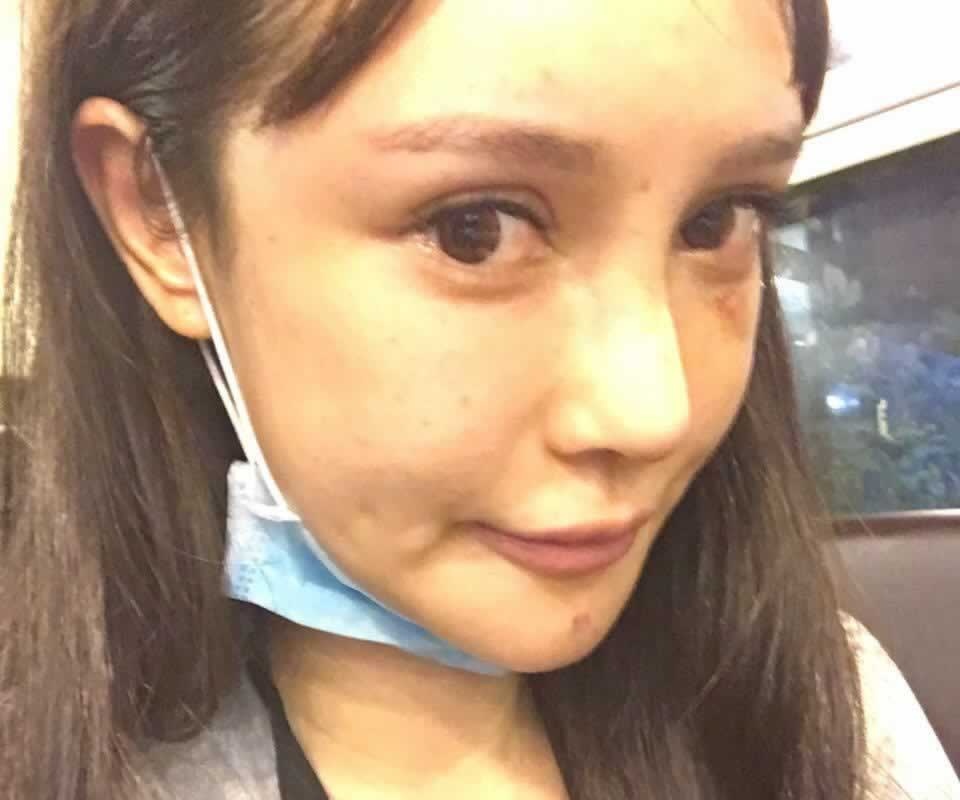 phau thuat tham my anh 4