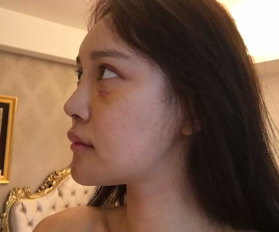 phau thuat tham my anh 5