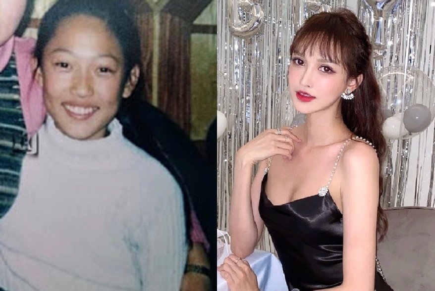 Hot girl Trung Quoc noi 'phau thuat tham my 300 lan' tu nam 14 tuoi hinh anh