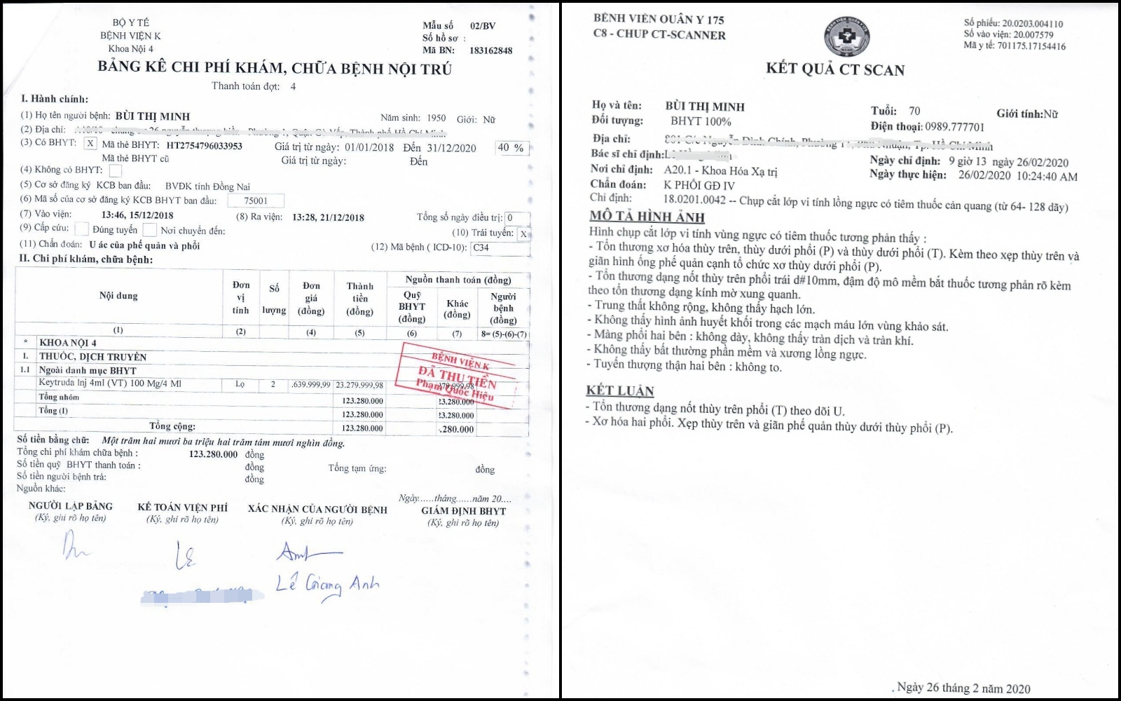 ban than chua ung thu cho me anh 3