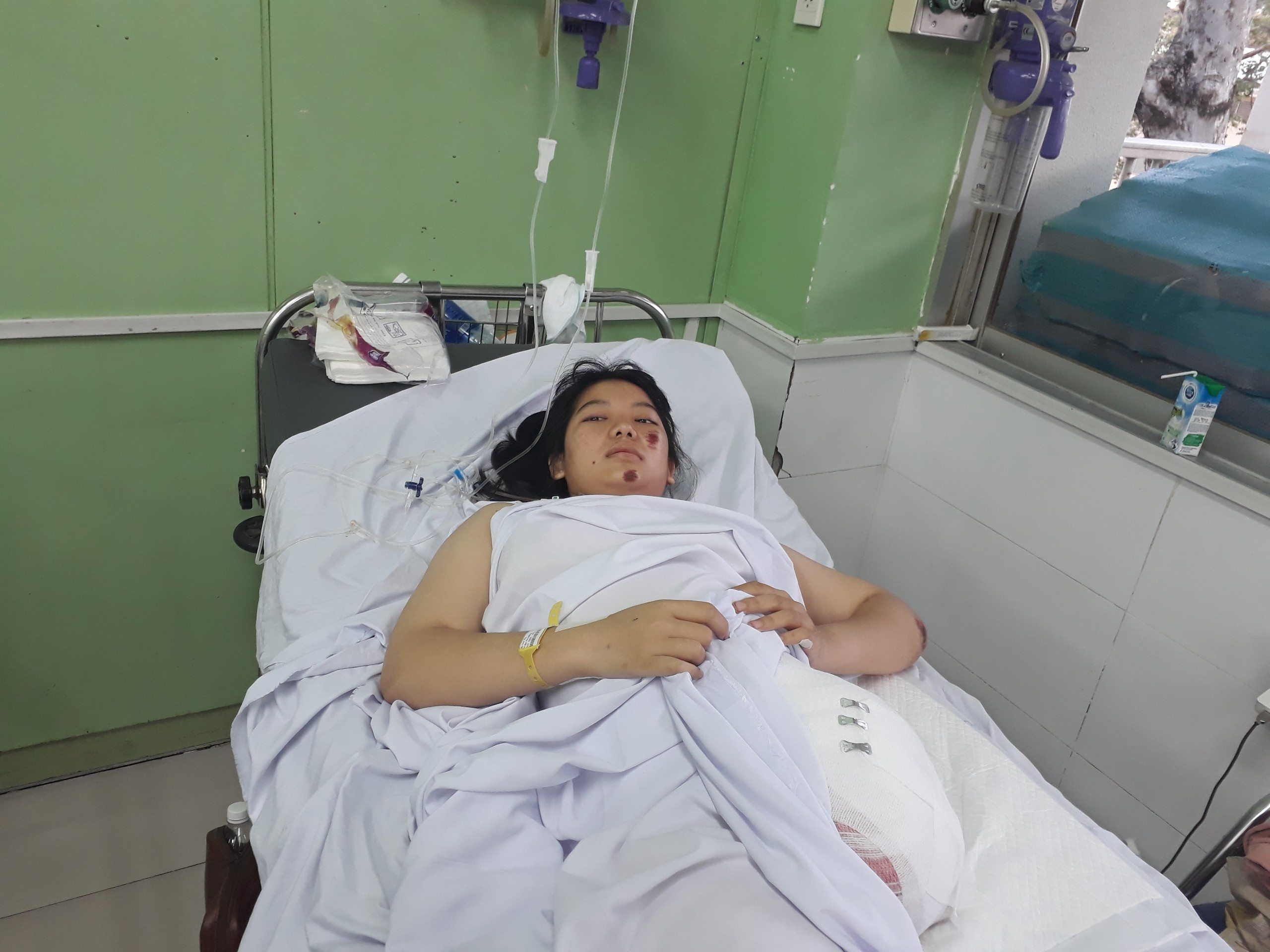 nu sinh mat chan vi tai nan anh 1