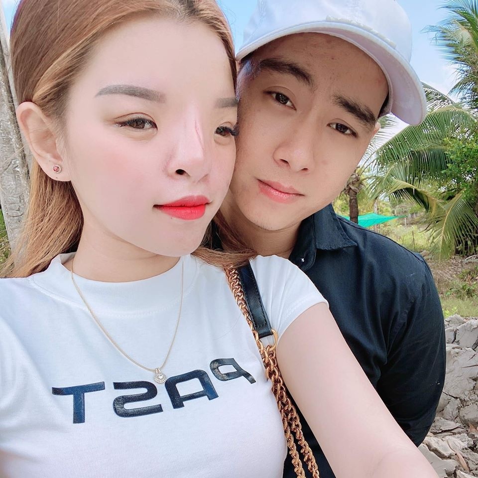 cô gái có gương mặt biến dạng ảnh 1 co gai co guong mat bien dang anh 1