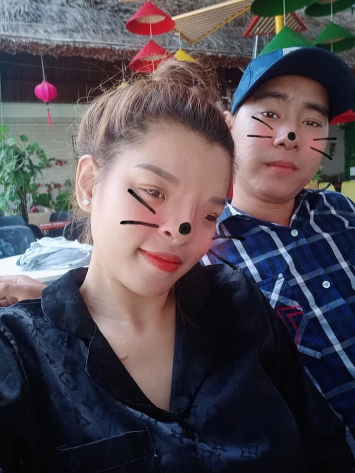 cô gái có gương mặt biến dạng ảnh 3 co gai co guong mat bien dang anh 3