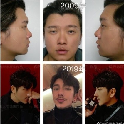 nam thần thẩm mỹ ảnh 4 nam than tham my anh 4