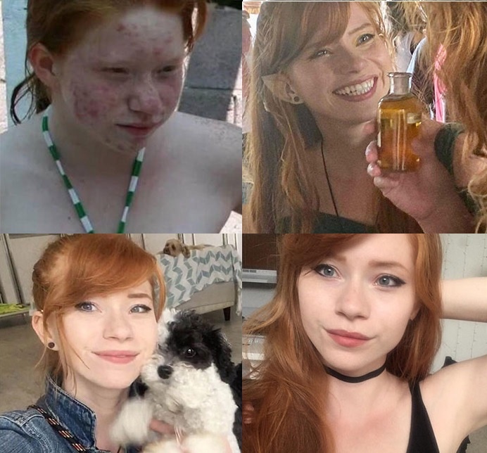 vit hoa thien nga anh 2