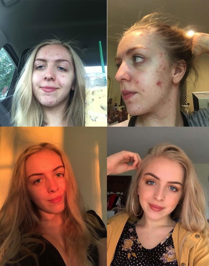 vit hoa thien nga anh 10