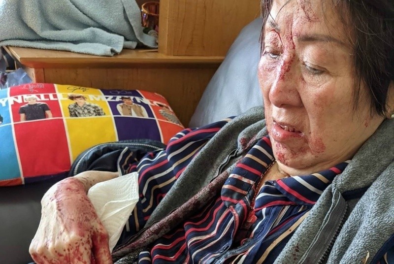 Nguoi phu nu Canada goc Viet bi tan cong tai nha rieng hinh anh