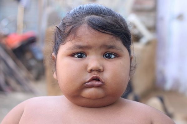 cô bé nặng nhất thế giới ảnh 5 co be nang nhat the gioi anh 5