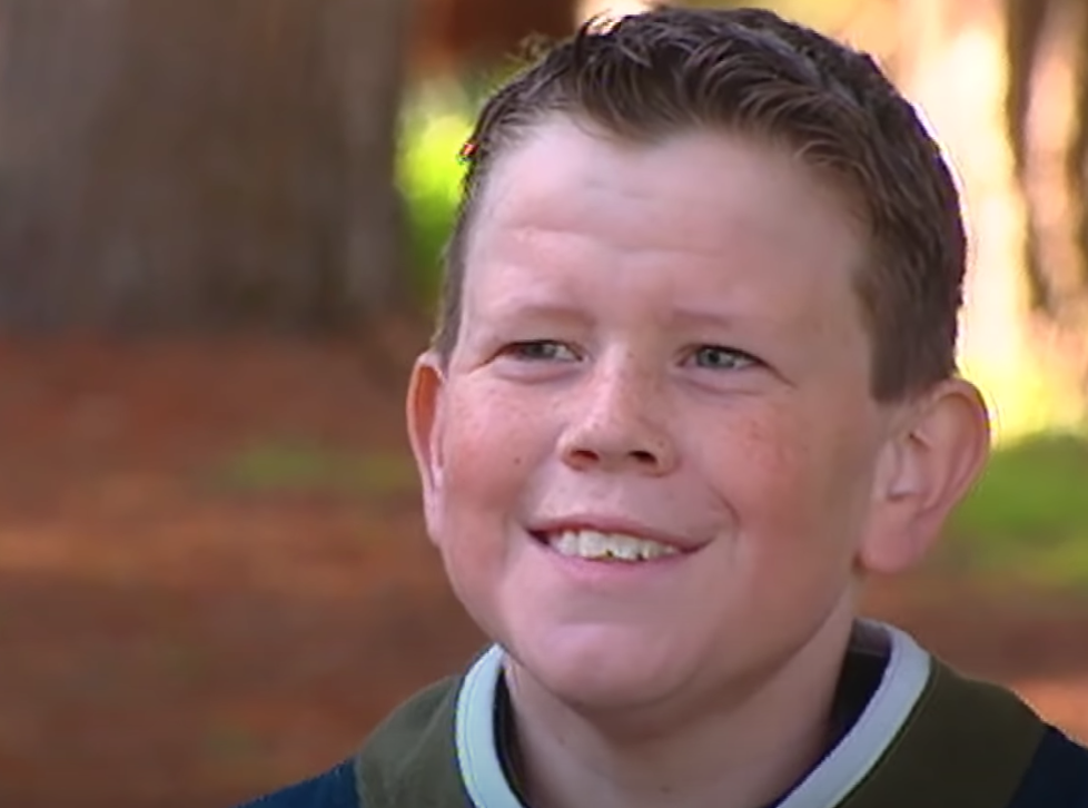 làn da nhăn nheo ảnh 4 lan da nhan nheo anh 4