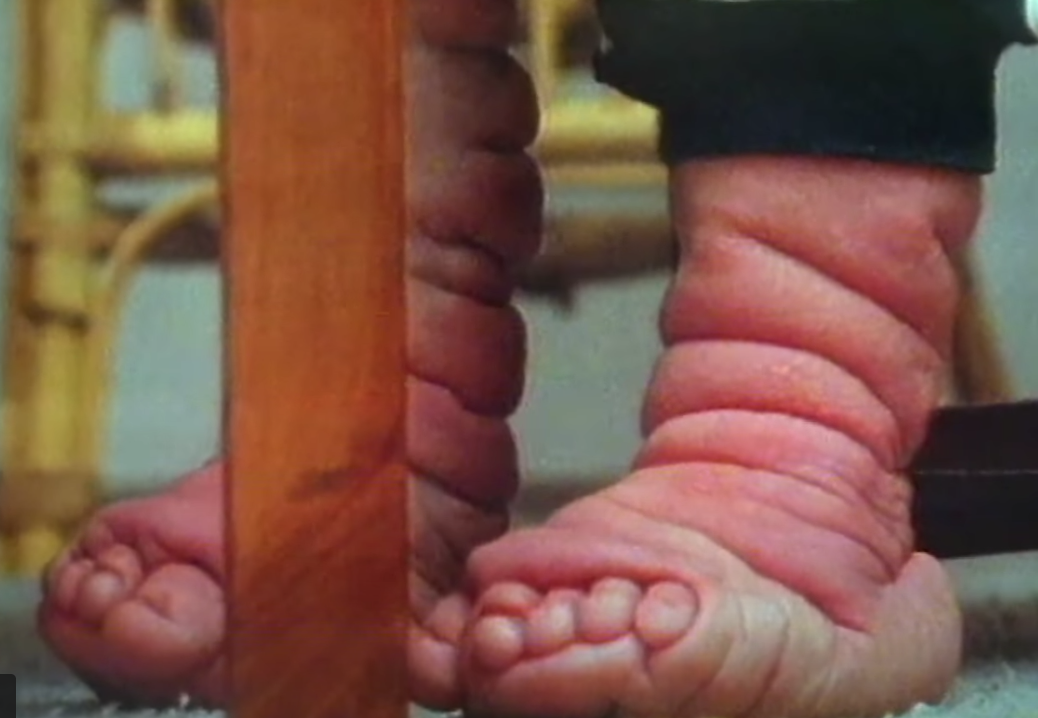 làn da nhăn nheo ảnh 2 lan da nhan nheo anh 2