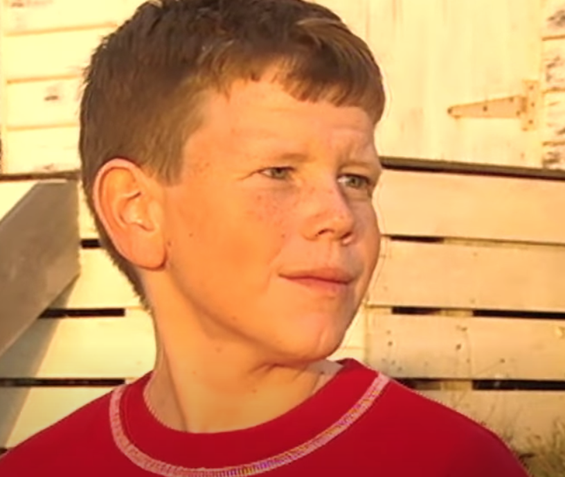 làn da nhăn nheo ảnh 3 lan da nhan nheo anh 3