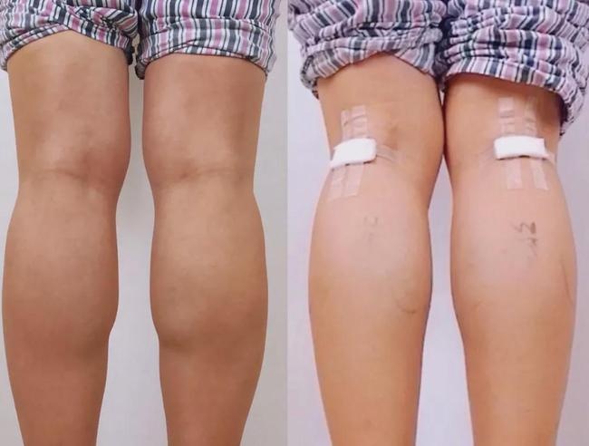 phau thuat tham my anh 2