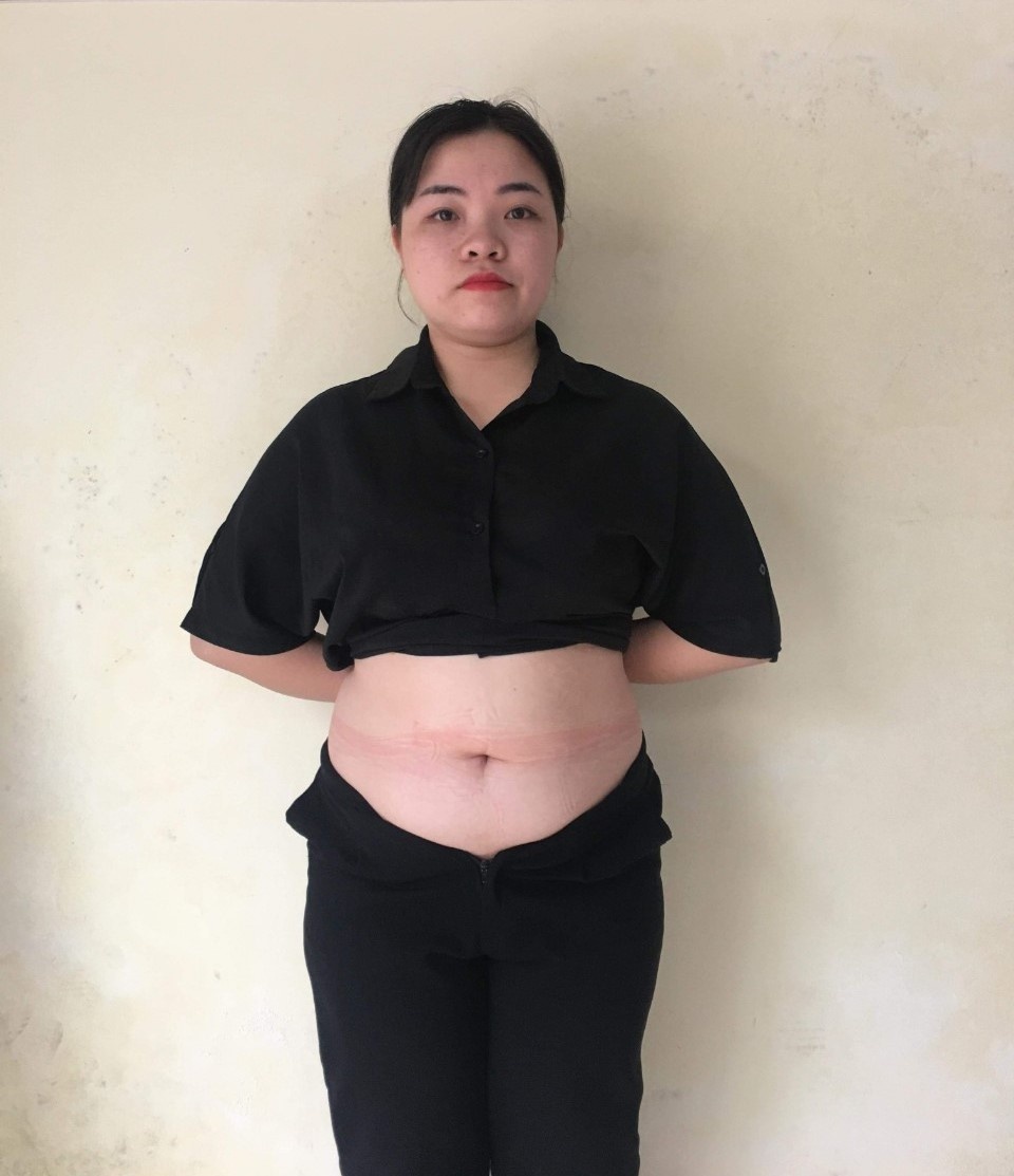 giảm cân thành công ảnh 3 giam can thanh cong anh 3