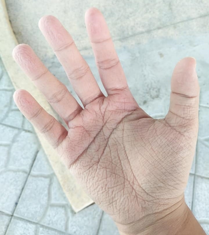 tình nguyện chống dịch ảnh 4 tinh nguyen chong dich anh 4