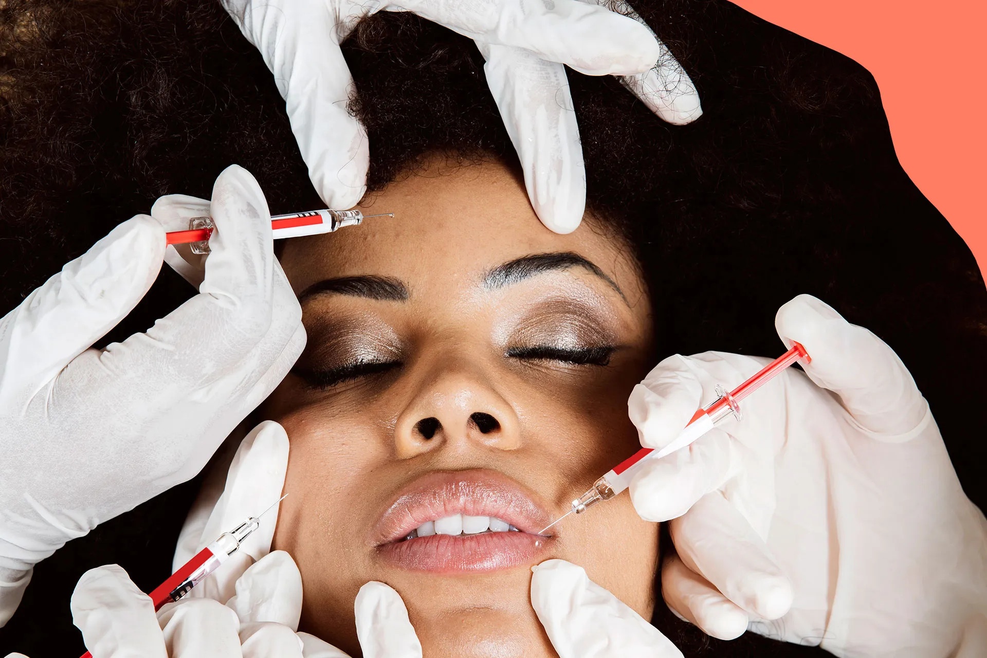 tiêm filler không giấy phép ảnh 1 tiem filler khong giay phep anh 1
