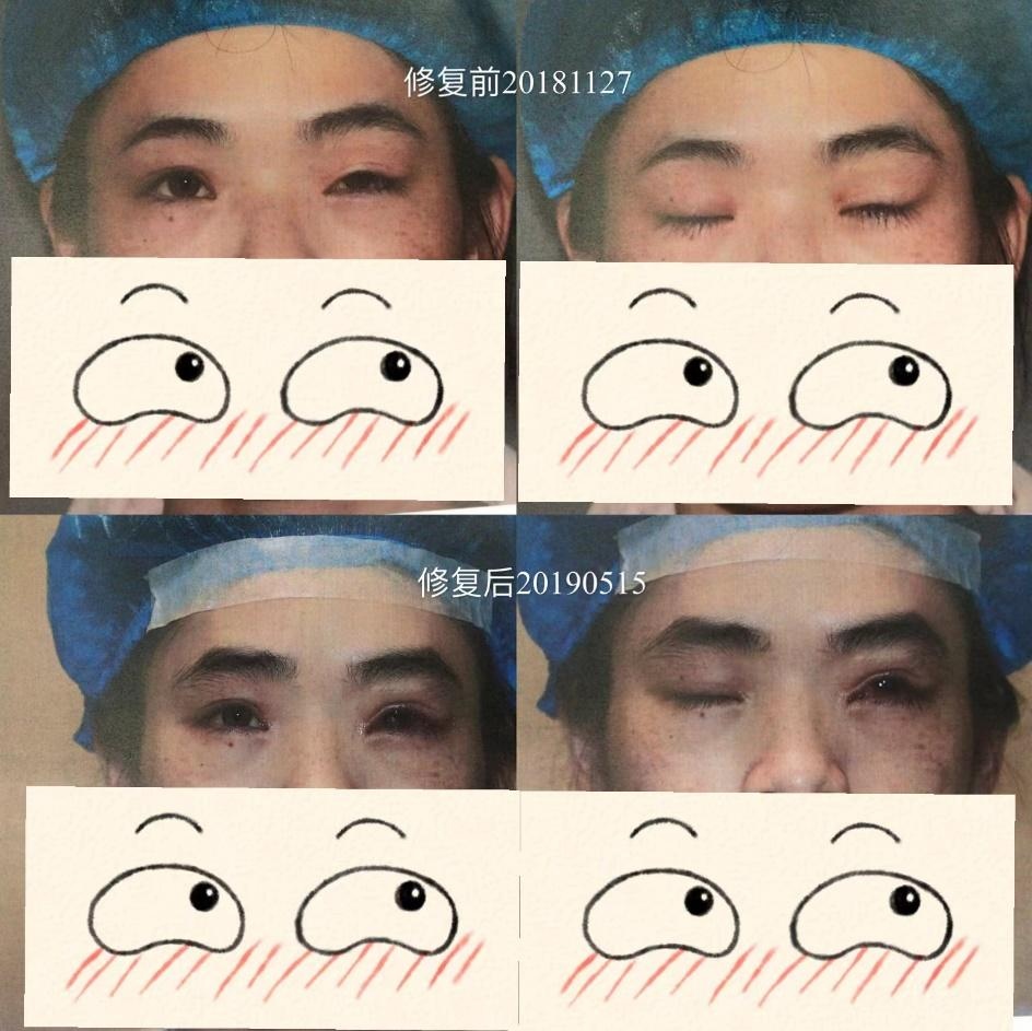 bien chung phau thuat tham my anh 1