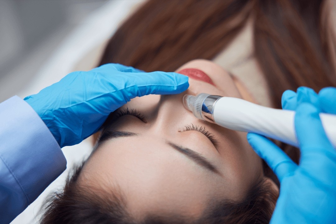 hoc sinh phau thuat tham my anh 4