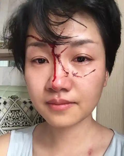 phu nu trung quoc bi bao hanh anh 2