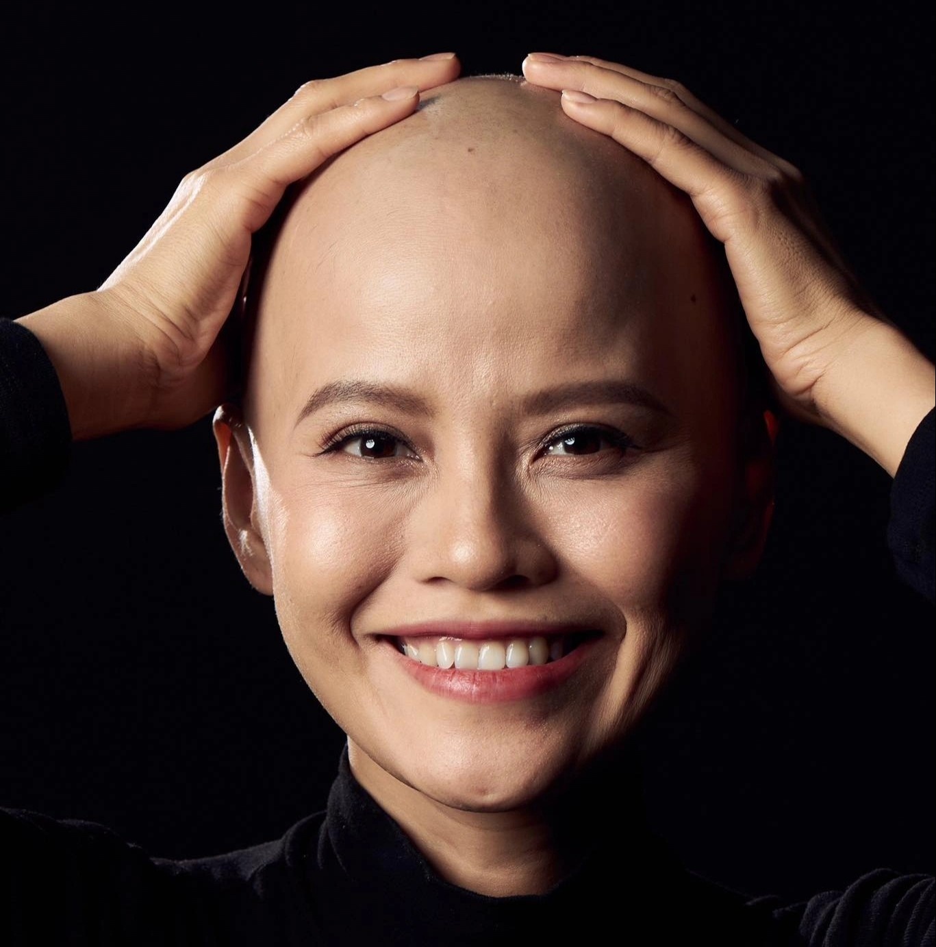 ung thư vú ảnh 3 ung thu vu anh 3