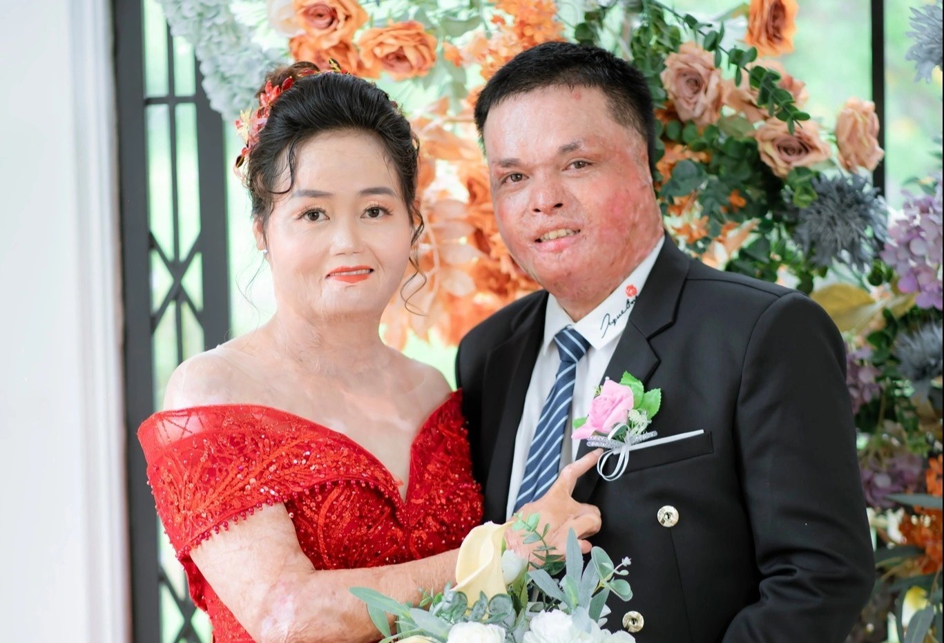 Hanh phuc moi cua nguoi tung bi chong cu thieu song hinh anh