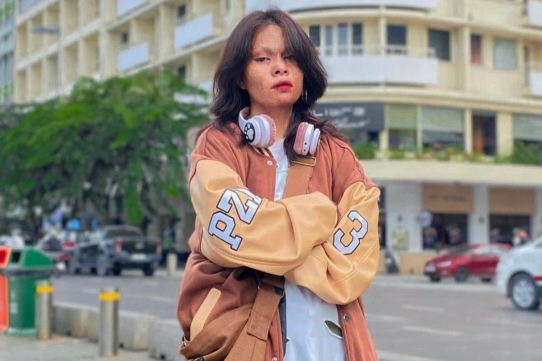 Cai om tren pho Nguyen Hue cua co gai co khuon mat bien dang vi bong hinh anh