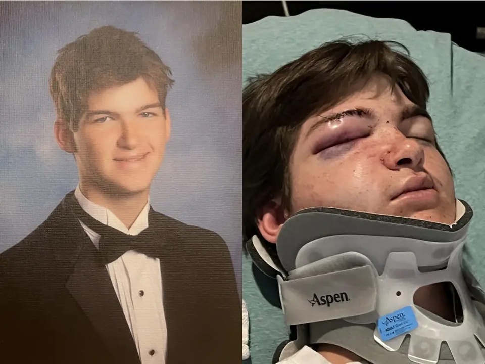 choi kham truong hoc anh 1