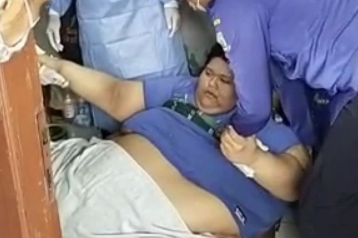 Pha cua, dung oto dua thanh nien Indonesia nang 300 kg den benh vien hinh anh