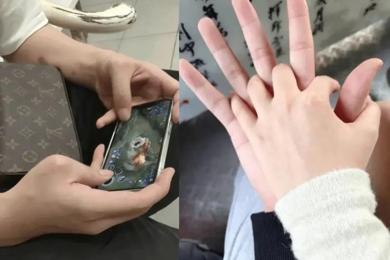 Dang sau ban tay bien dang cua Meo Beo hinh anh