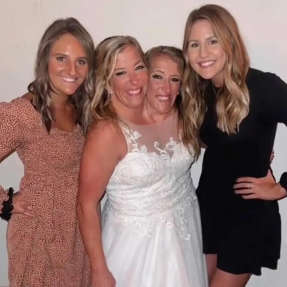 song sinh dinh lien anh 5