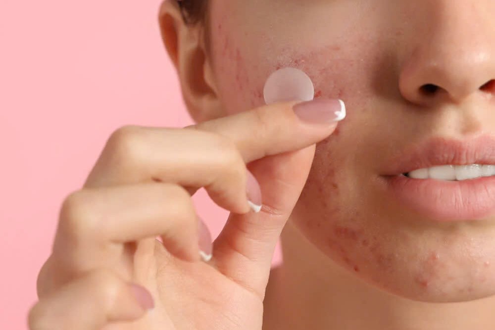 Dieu it biet ve mieng dan mun hinh anh