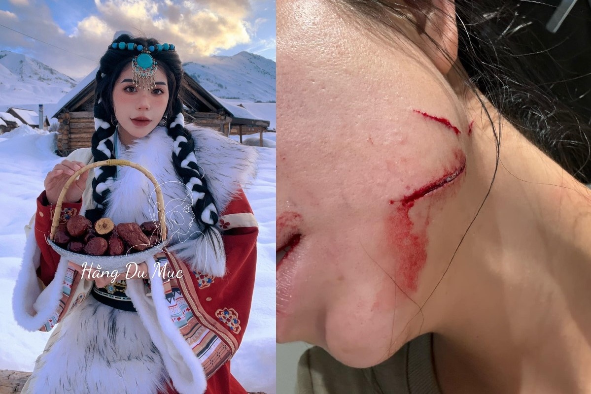 Hang Du Muc dang anh to chong bao hanh, rach mat hinh anh