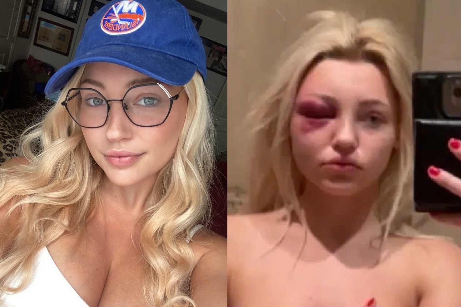 Nguoi mau My 25 tuoi bi ban trai bac si bien thanh 'no le tinh duc' hinh anh