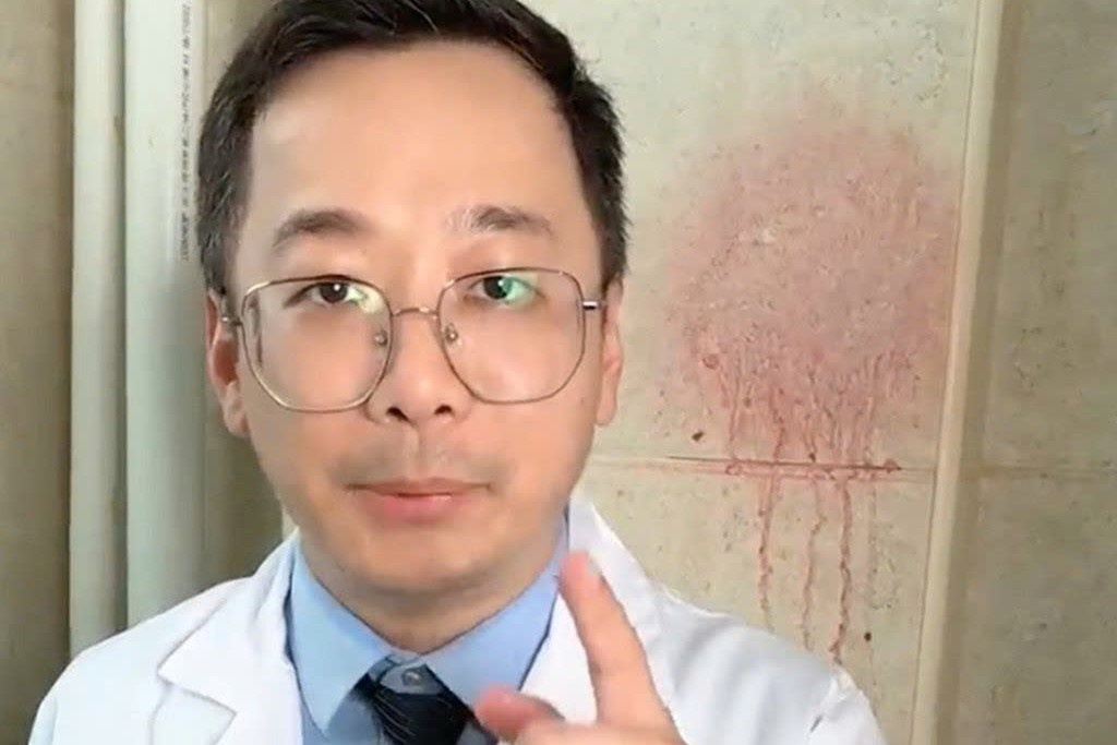 Influencer Trung Quoc day xoa vet mau, lam tan xuong gay lo ngai hinh anh