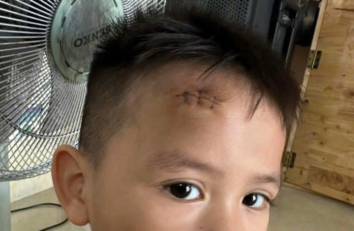 khoi nghi he anh 4