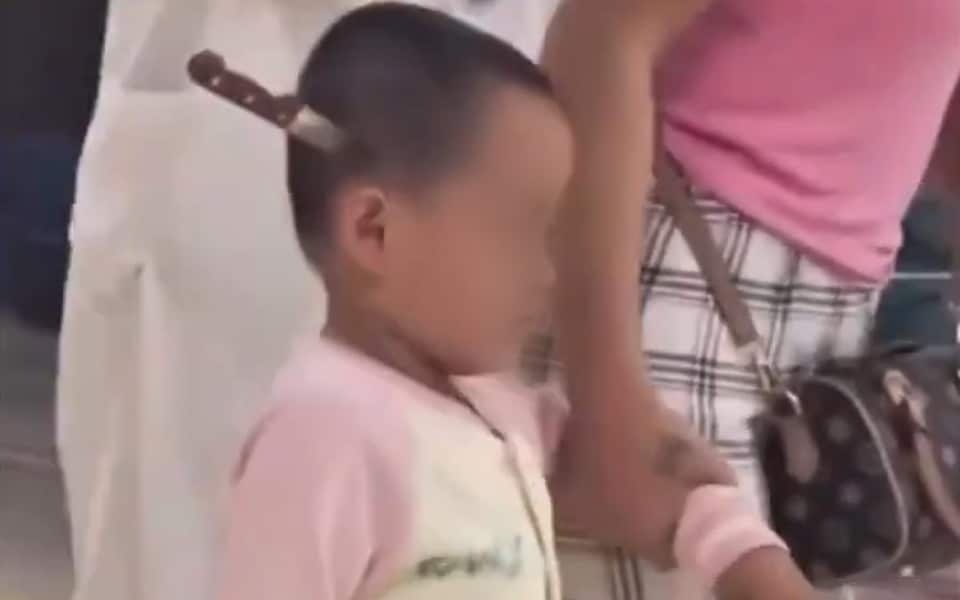 Be 3 tuoi di bo vao benh vien Trung Quoc voi con dao cam vao dau hinh anh