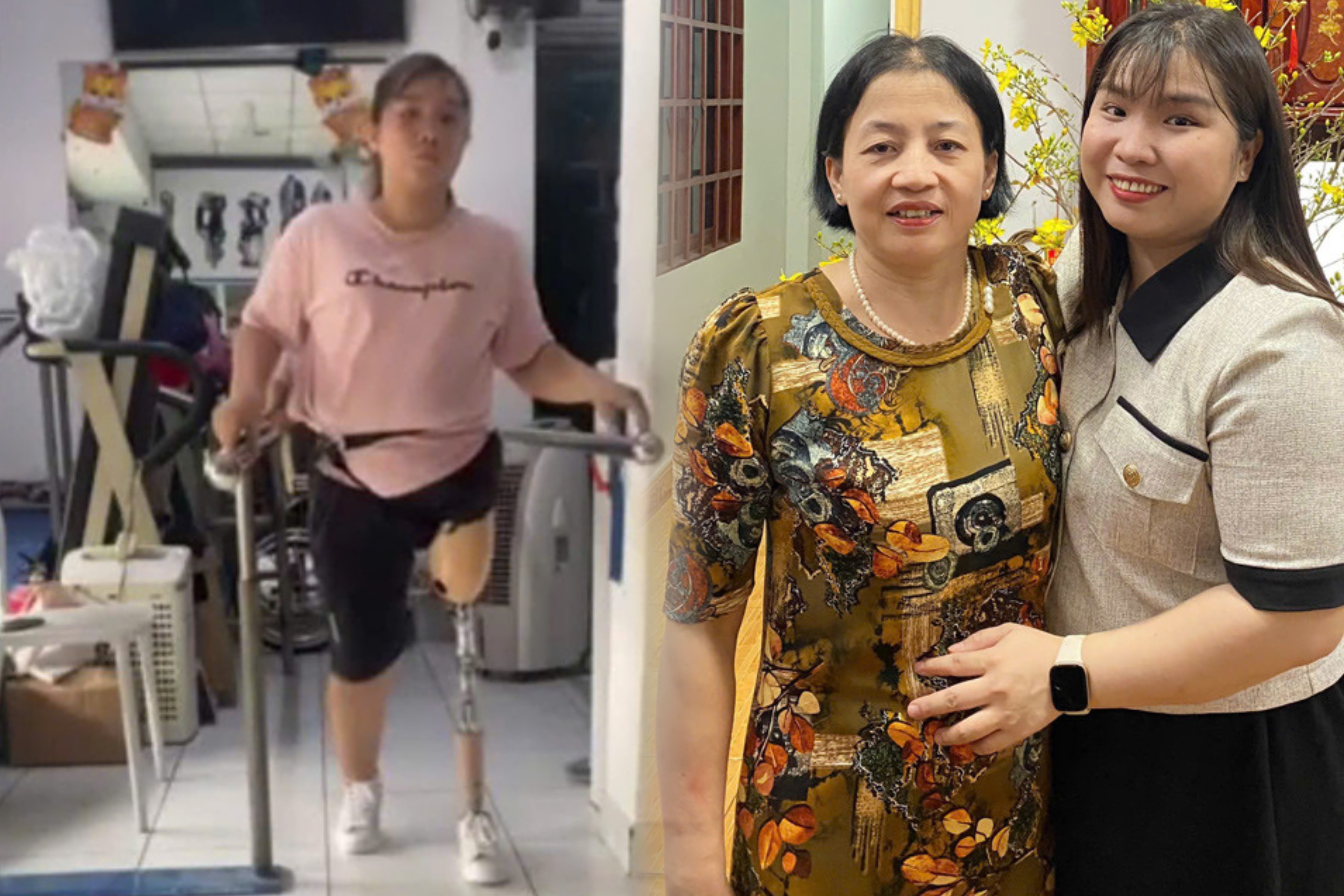 Thuong con dau mat mot chan, me chong TP.HCM cham bam nhu con ruot hinh anh