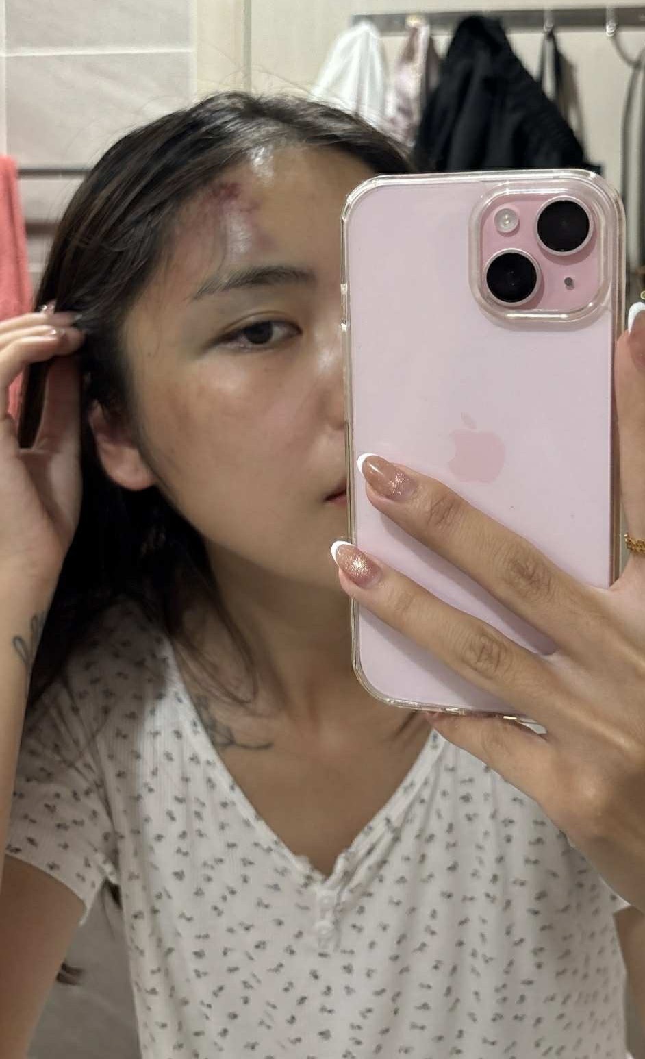 danh vo o chung cu anh 2