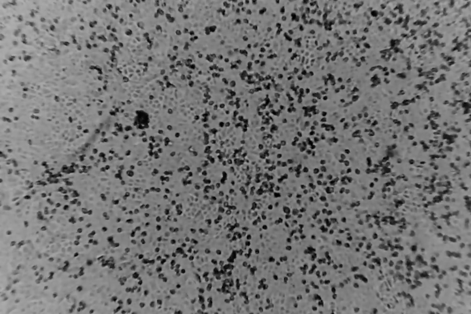 Australia tai tao thanh cong virus corona tren co the nguoi hinh anh