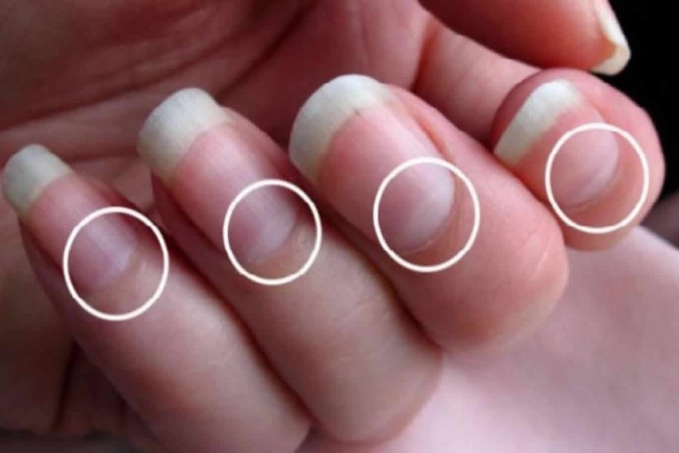 Hinh dang liem mong tay tiet lo cac van de ve suc khoe hinh anh