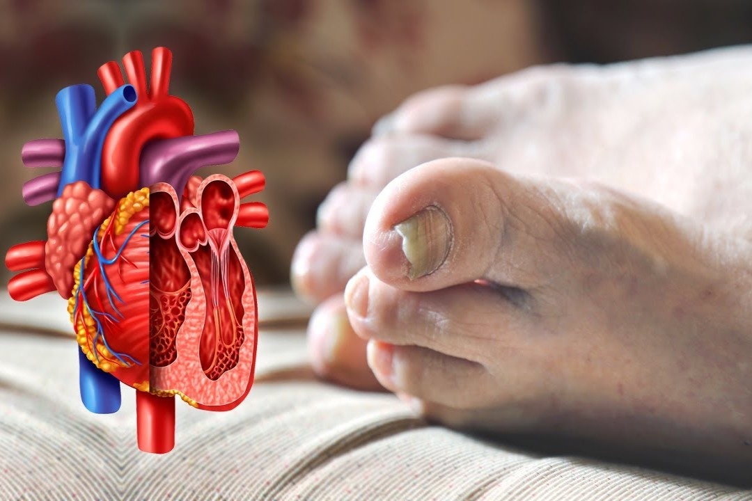 Tay, chan lanh canh bao suc khoe gap van de gi? hinh anh