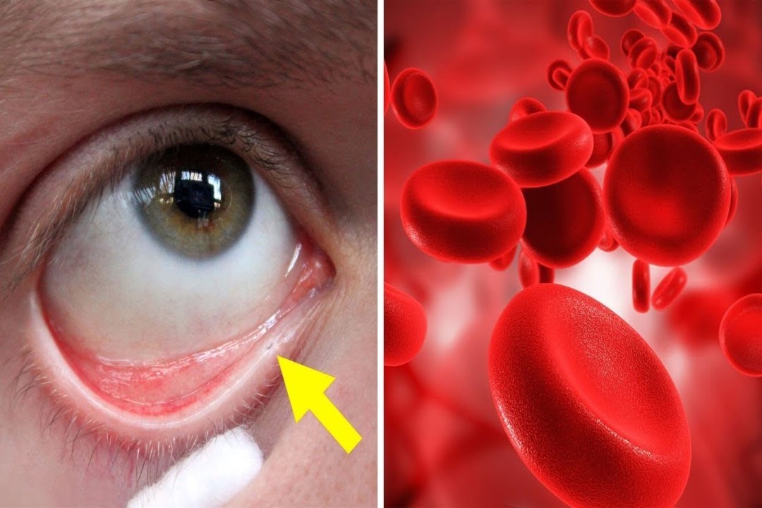 Dau hieu canh bao co the thieu mau hinh anh