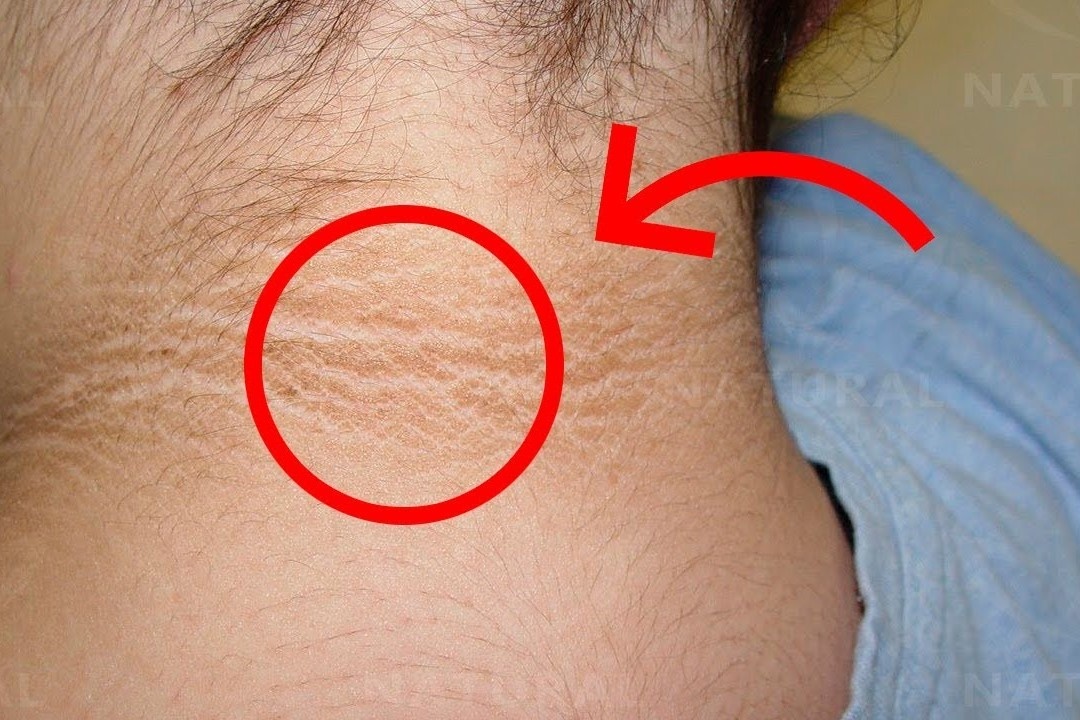 8 dau hieu som cua benh tieu duong hinh anh