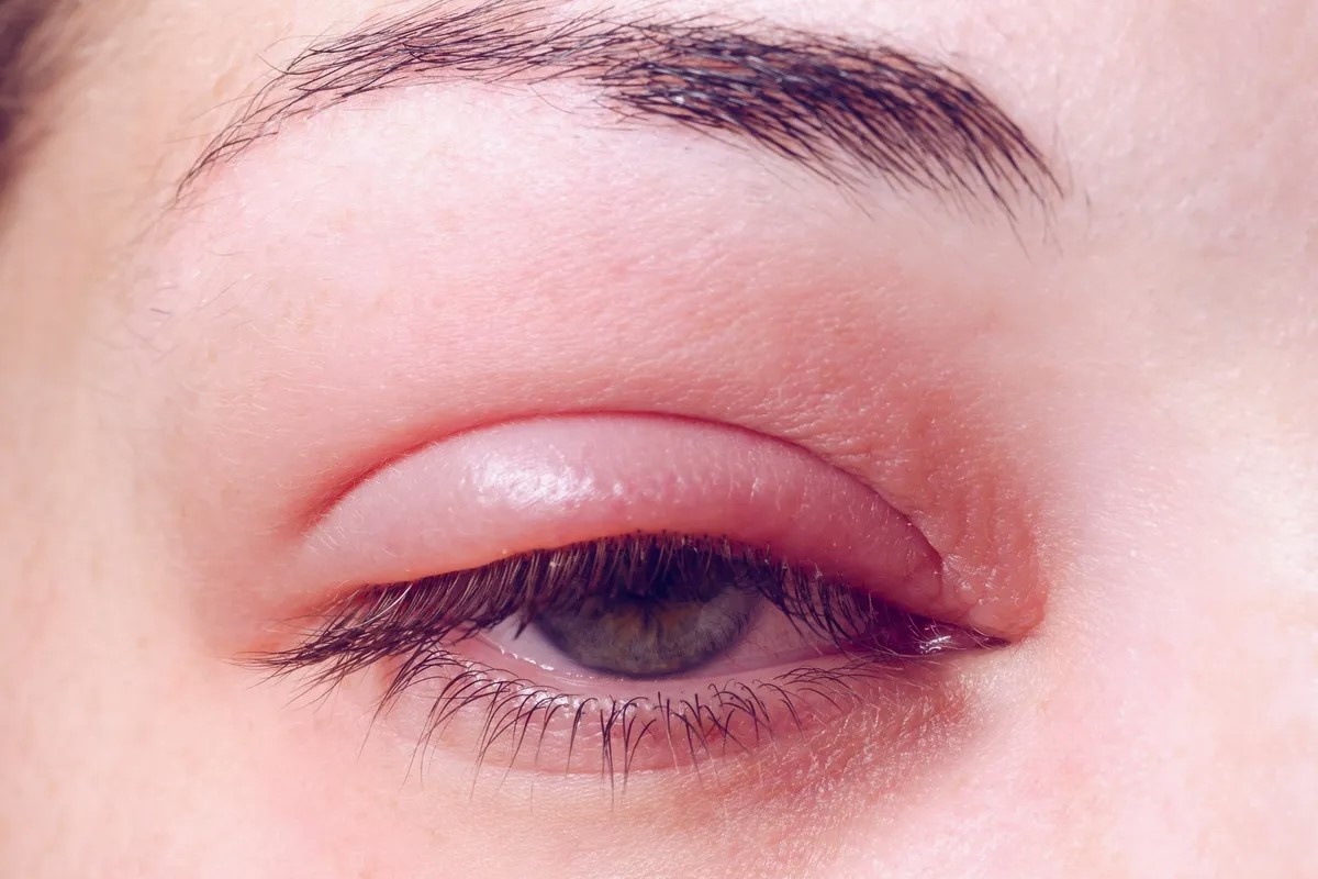 Nhung dau hieu o mat tiet lo cac van de suc khoe hinh anh